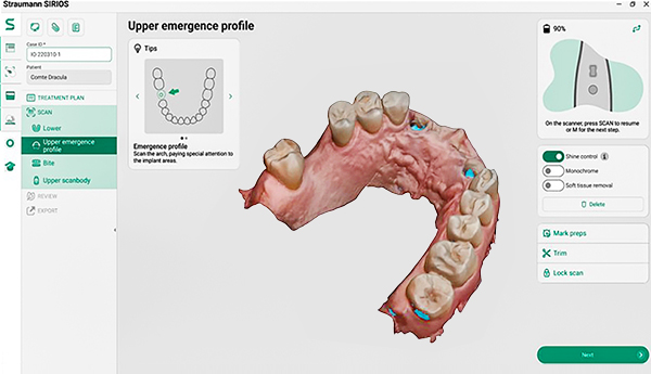 二次手術、型採り